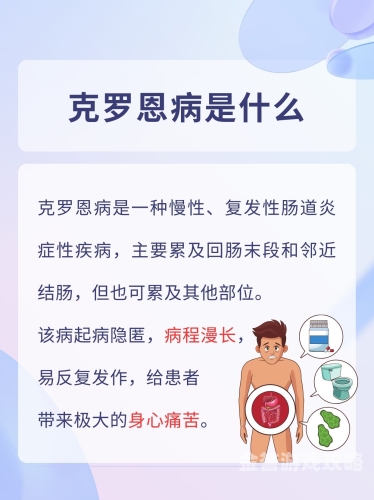 溃疡性结肠炎与克罗恩病，差异、挑战与应对溃疡性结肠炎和克罗恩病的区别表格